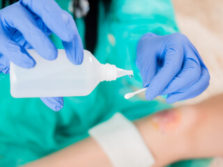 Close-up of a cotton swab and a bottle of antiseptic in the hands of a doctor against the background of a wound on the patient's leg.