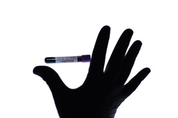 virus blood tube hand and hand shadow covid -19