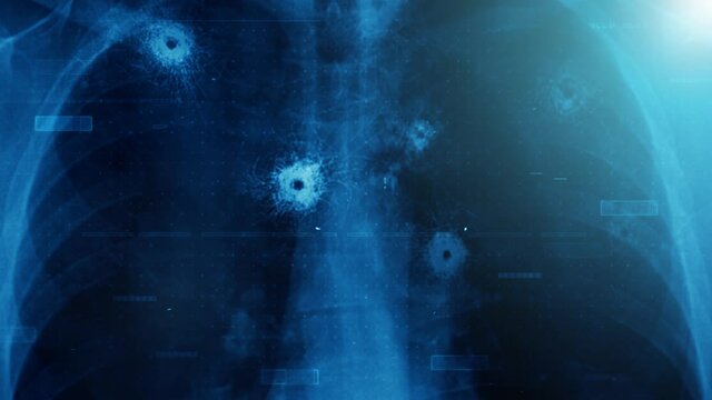 Xray Crime Cinematic Glitch