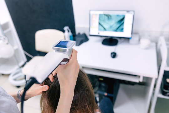 Trichological examination of the scalp and hair follicles in a c