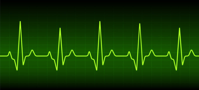 ECG heartbeat monitor, cardiogram heart pulse line wave. Electrocardiogram medical background