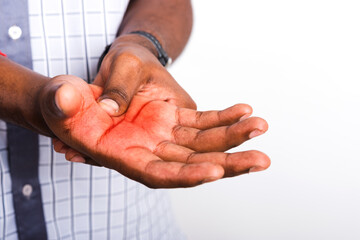 Closeup hand Asian black man holds his palm hand injury, feeling pain, studio shot isolated on...