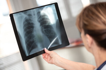 Female doctor examining x-ray report
