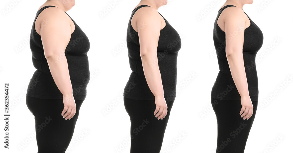 Canvas Prints Collage with photos of overweight woman before and after weight loss on white background,closeup. Banner design