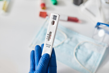 Doctor holding a test kit for viral disease coronavirus. Lab card kit test for COVID-19 2019-nCoV. Rapid test device virus