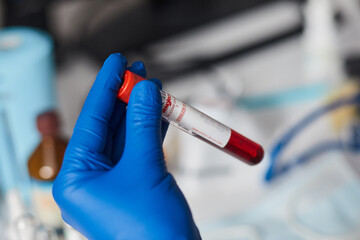 Doctor scientist holding test tube with blood for 2019-nCoV analyzing. Novel Chinese Coronavirus blood test Concept. Blood Sample Vaccine research.