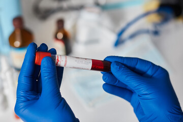 Doctor scientist holding test tube with blood for 2019-nCoV analyzing. Novel Chinese Coronavirus blood test Concept. Blood Sample Vaccine research.