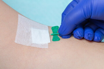 The doctor or nurse will take the blood with a butterfly needle. Taking a blood for tests. Blood...