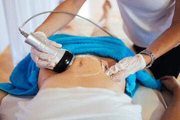 Cavitation RF body treatment and contemporary medicine for health beauty improvement and fat and...