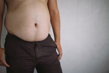Overweight man with excess belly fat, copy space. Weight loss, diet and health care concept