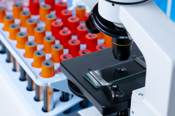 Microscope with blood samples test tubes close up