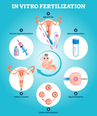 In Vitro fertilization artificial pregnancy reproduction vector illustration
