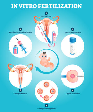 In Vitro fertilization artificial pregnancy reproduction vector illustration