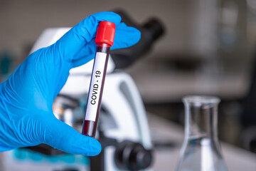 Researcher or medical technician doctor holding test tube contain blood sample with COVID-19 infection in laboratory for research to discover vaccine..