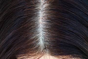 Womens head with gray hair, close-up view of regrown roots, top view.