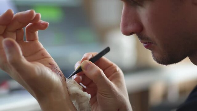 Man cleaning a bleeding wound under the skin after the accident.Traumatic pain of a hand. Treatment and disinfection of deep wounds.