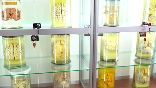 human organs in formalin in anatomical museum