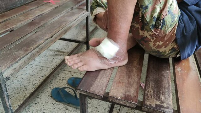 Footage real time close-up foot of an asian patient with gauze waiting in hospital