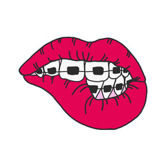 Sexy lips and teeth in bright color braces on an isolated white background. Beautiful vector illustration for design and print on fabric, stickers, greeting card. Kiss day, oral care concept.