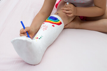 Fractures of the child’s legs. A teenager girl is resting in the orthopedic ward in the ward after first aid. A baby leg in plaster on a white bed.Close up