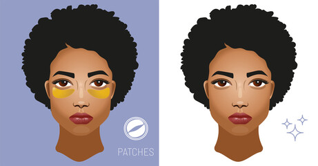 Cosmetic gold eye patches. Beautiful face of a young african american black woman  with hydrogel gold patches under her eyes taking care of the skin. 