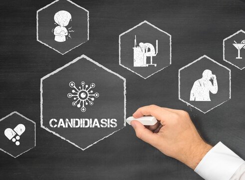 candidiasis
