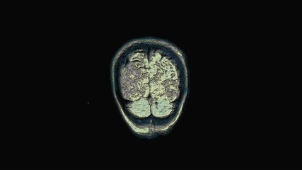 Bulk multicolored MRI brain, head scans and tumor detection. Diagnostic medical tool