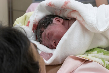 Obraz na płótnie Canvas 出産直後の新生児と母親