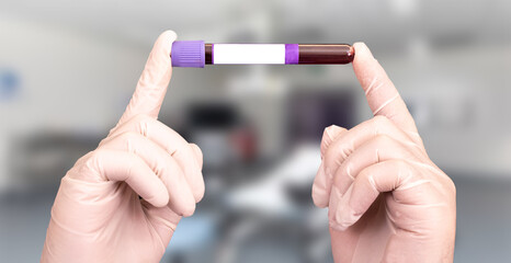 Blood test sample for presence detection of Coronavirus in the hands of doctor with gloves in Covid-19 reseach laboratory. Space for text on the test tube label