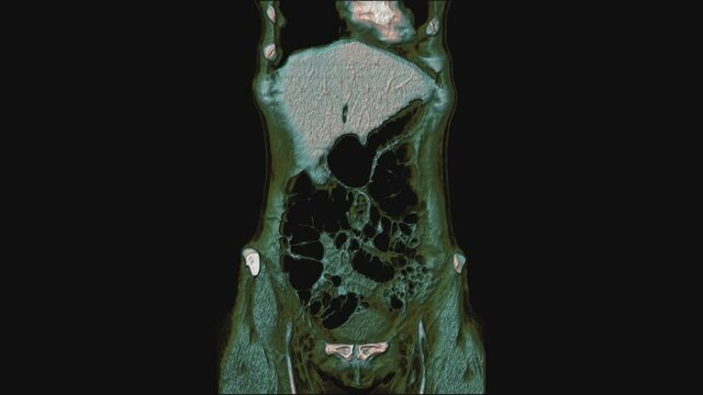 Bulk multicolored MRI of the female pelvic organs, abdominal cavity, gastrointestinal tract and bladder