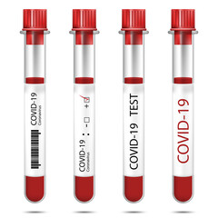 Test tube collection with blood sample for COVID-19 isolated on white background.