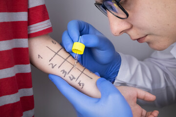 An allergist doctor makes a skin test for allergies. The boy is being examined in the laboratory,...