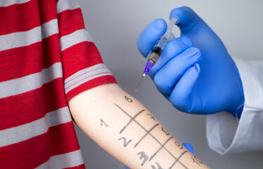 An allergist doctor makes a skin test for allergies. The boy is being examined in the laboratory,...