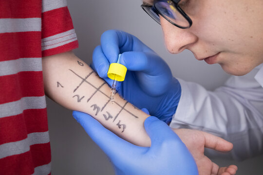 An Allergist Doctor Makes A Skin Test For Allergies. The Boy Is Being Examined In The Laboratory, Waiting For A Reaction To Allergens.