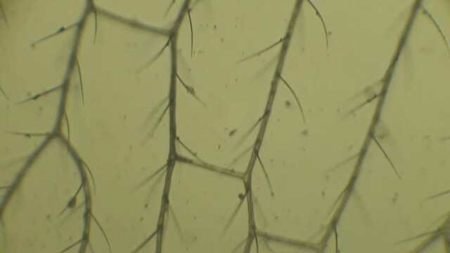 Microscopy of insect small fruit flies. Magnification 150x with visible wing segments and hairs in detail.