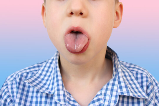 boy, kid performs articulation exercises for the development of the speech apparatus, close-up tongue, concept of speech disorders, methods for their correction, methods exercises