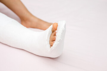 Leg in plaster of a teenage girl on a pink bed after an accidental fall with an ankle fracture.Fracture of the lower leg in a child