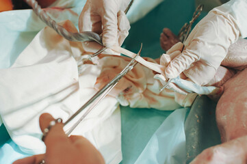 A doctor holds the umbilical cord of a newborn child with clips and the father cuts it with scissors in the maternity home, The birth of the baby.The concept of health care - obrazy, fototapety, plakaty