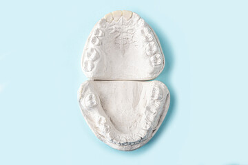 Stomatologic plaster cast, molds of human jaws and teeth on blue background. Dental casting gypsum for manufacture of dentures, braces or false teeth. Dentistry and orthodontics concept.