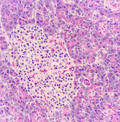 Photo of islets of langerhans (left side) in pancreatic tissue, magnification 400x