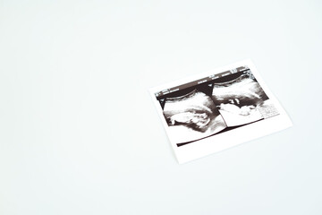 Result of ultrasound picture or ultrasonography for pregnancy on top of white isolated background
