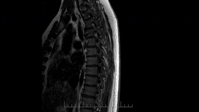 MRI spine scan, magnetic resonance imaging of a back and skeleton close-up, time lapse
