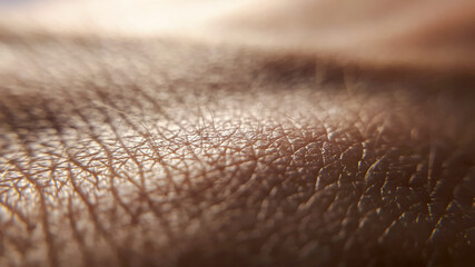 Skin cancer. Unhealthy skin. Human skin hand. Macro textured background.