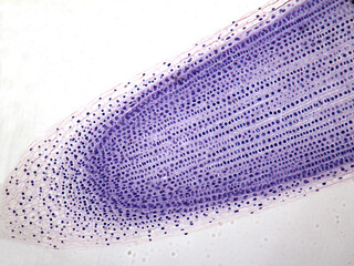Microphotography of root mitosis of an onion.
