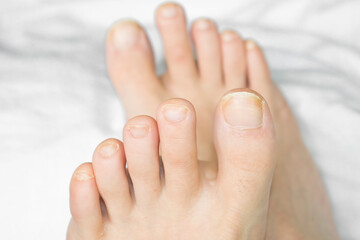 Toenails on a woman's feet