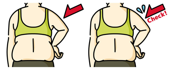 肥満の女性の二の腕と背中-チェック