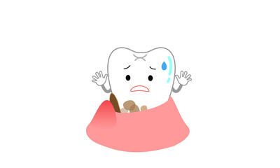 歯周ポケットに歯垢や汚れがついて虫歯に進行しそうな歯
