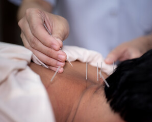 Acupuncture  massage