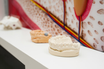 gypsum models of different human jaws and teeth on a white shelf in the dentist's office