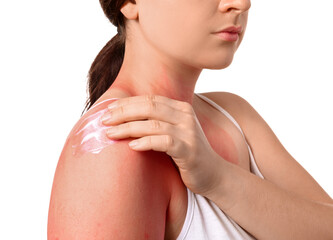Woman with red sunburned skin applying cream against white background, closeup